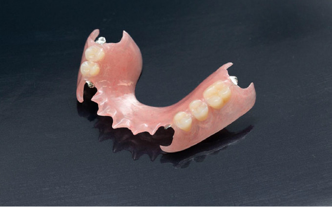 ノンクラスプデンチャー